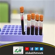 الإيدز!.. إحصائيات مخيفة.. وعلاجات ضعيفة (خطبة)