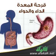 قرحة المعدة: الداء والدواء
