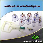 مواضع الحجامة لمرض الروماتويد