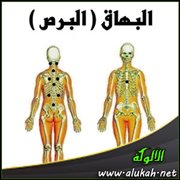 مواضع الحجامة لمرض البهاق ( البرص )