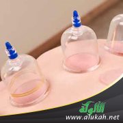 الحجامة: أحكام وحكم